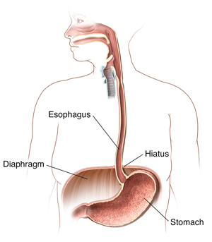 Outline of woman showing mouth, esophagus, and stomach.